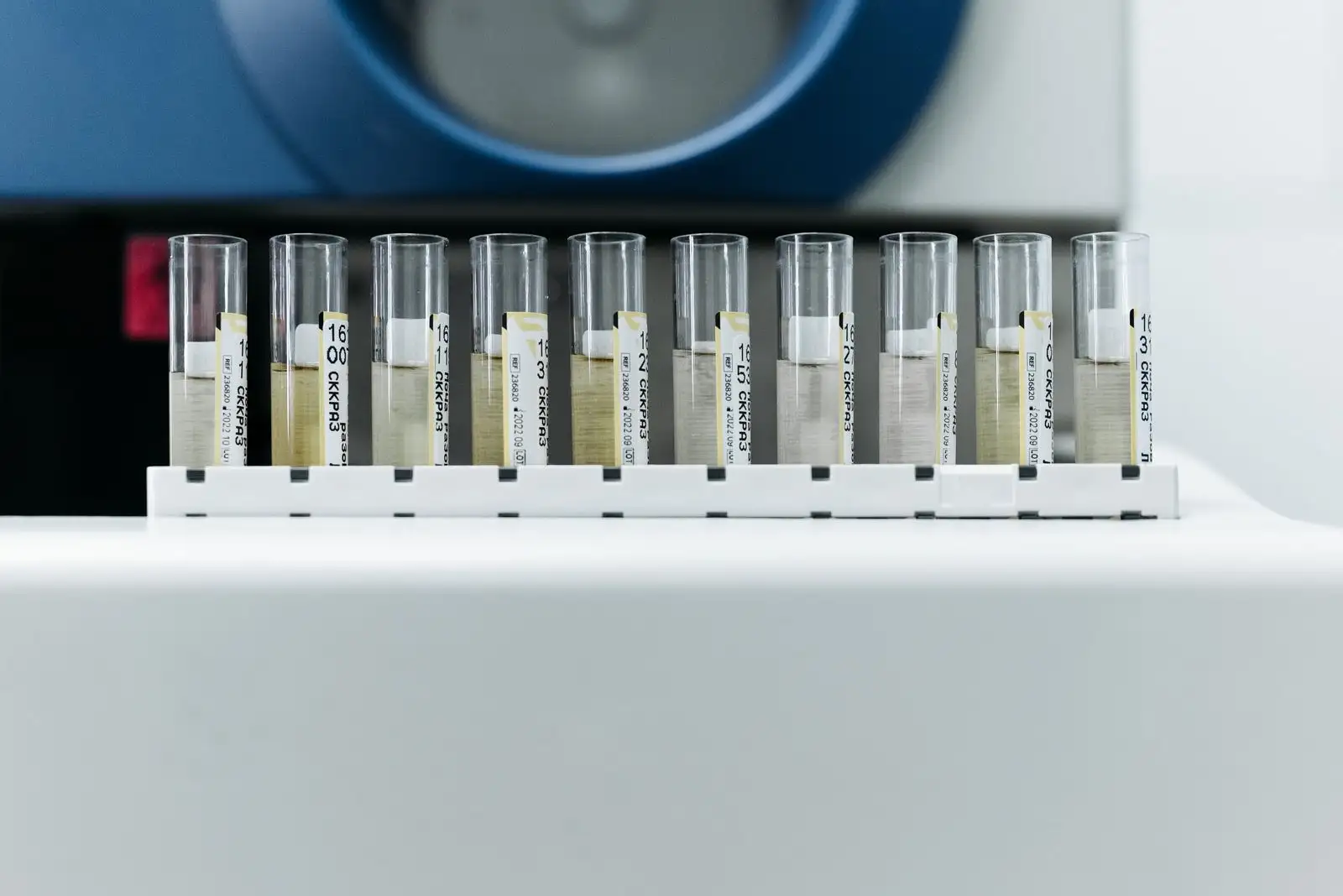 Row of labelled urine sample tubes standing in front of a laboratory analyser