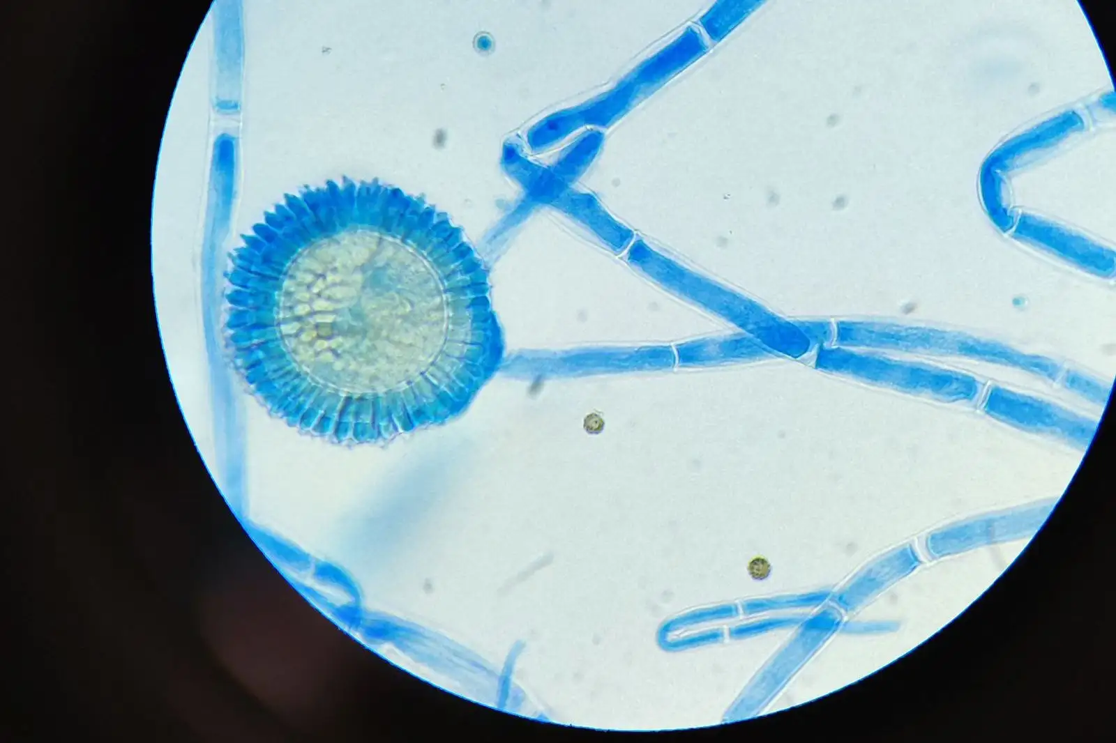 Mould on CBD flower: the signs and their limits