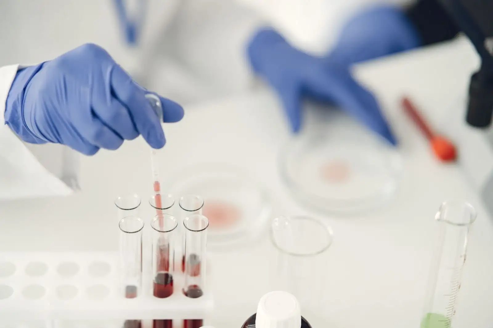 Gloved hands pipetting a sample above test tubes in a laboratory