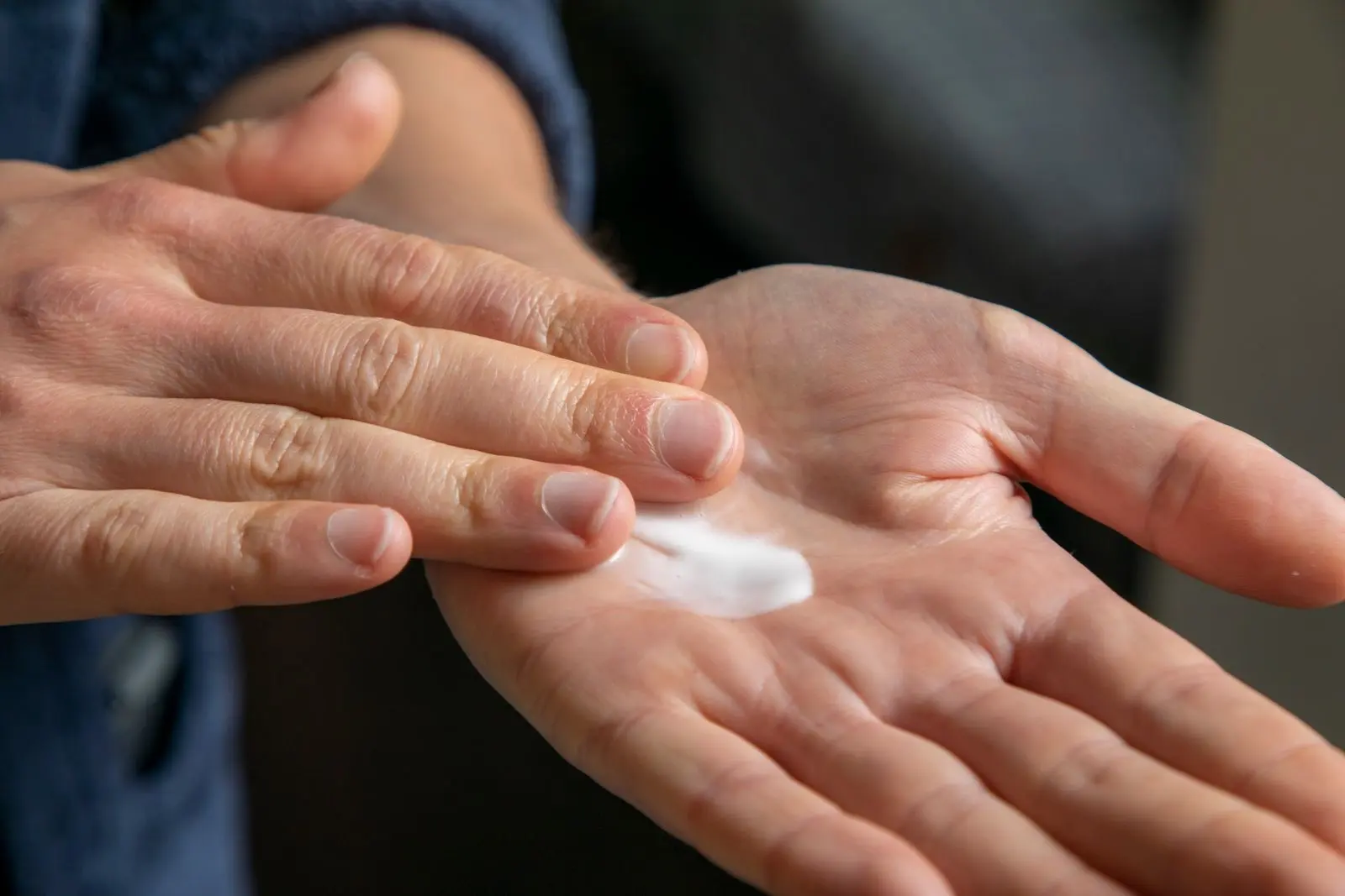 A dab of white cream in the palm of a hand, ready to be applied