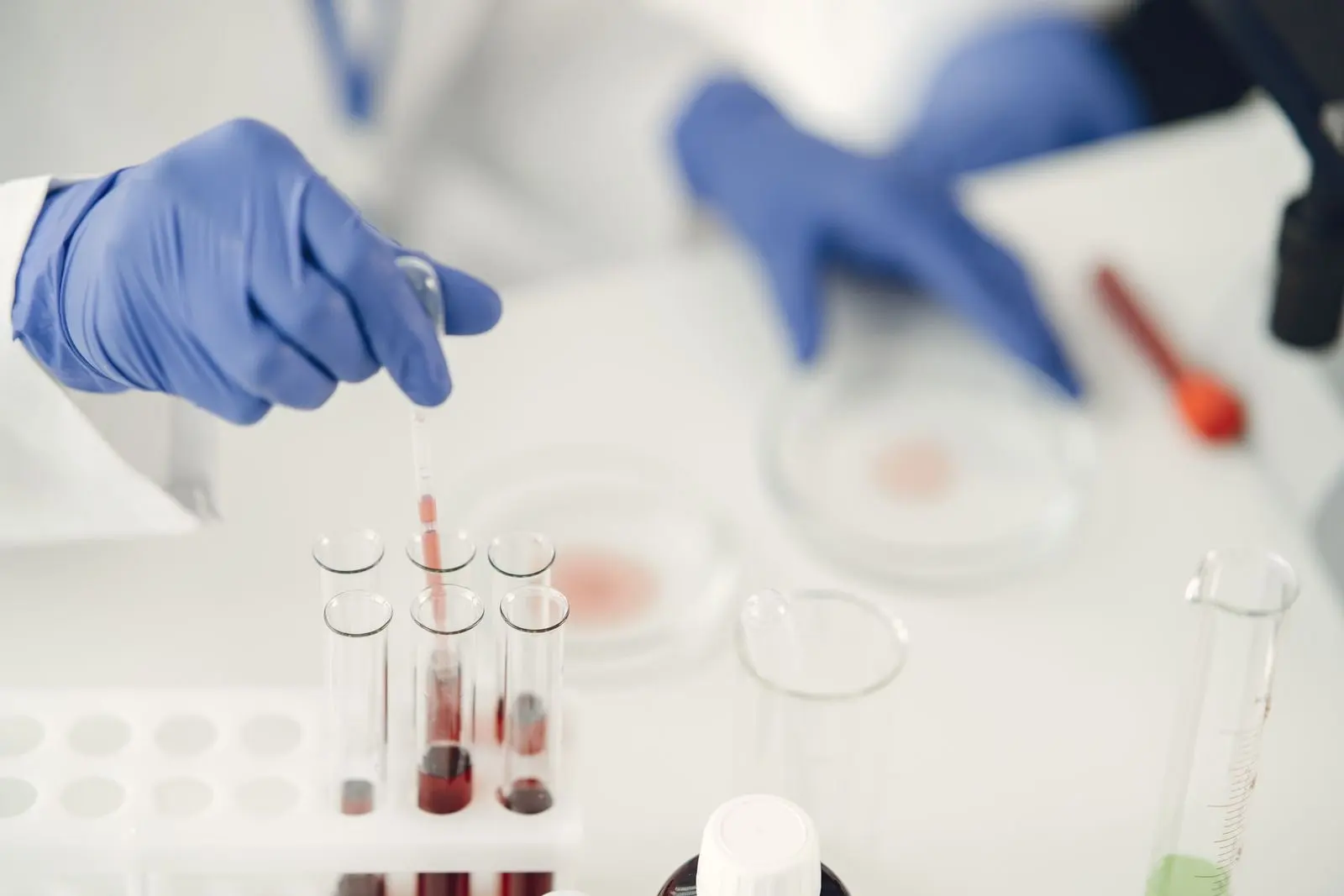 Gloved hands pipetting a sample above test tubes in a laboratory